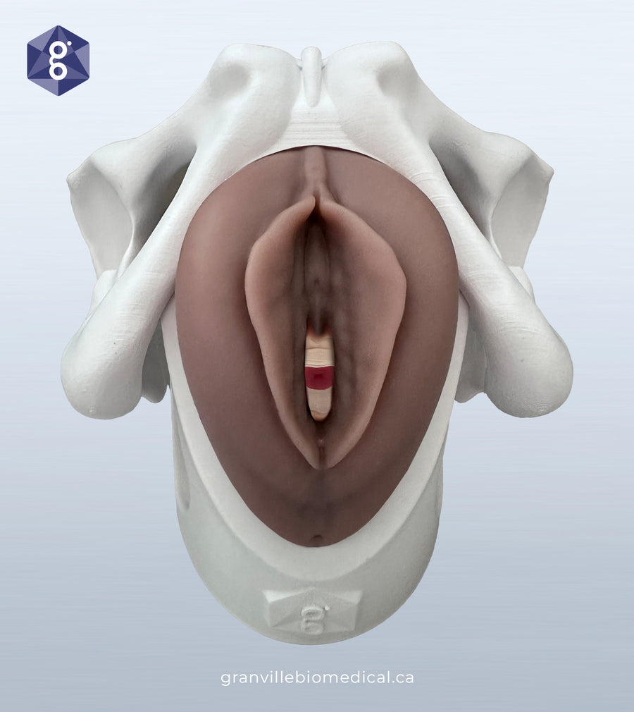 Iris - Pessary & Device Demonstration Model