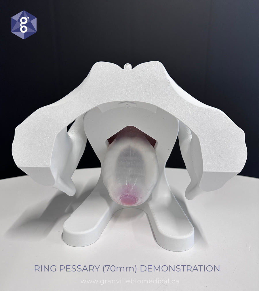 Iris - Pessary & Device Demonstration Model