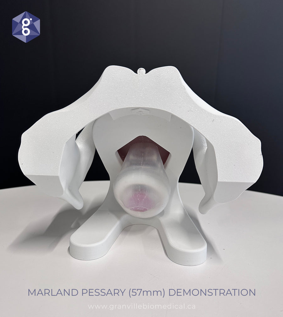 Iris - Pessary & Device Demonstration Model