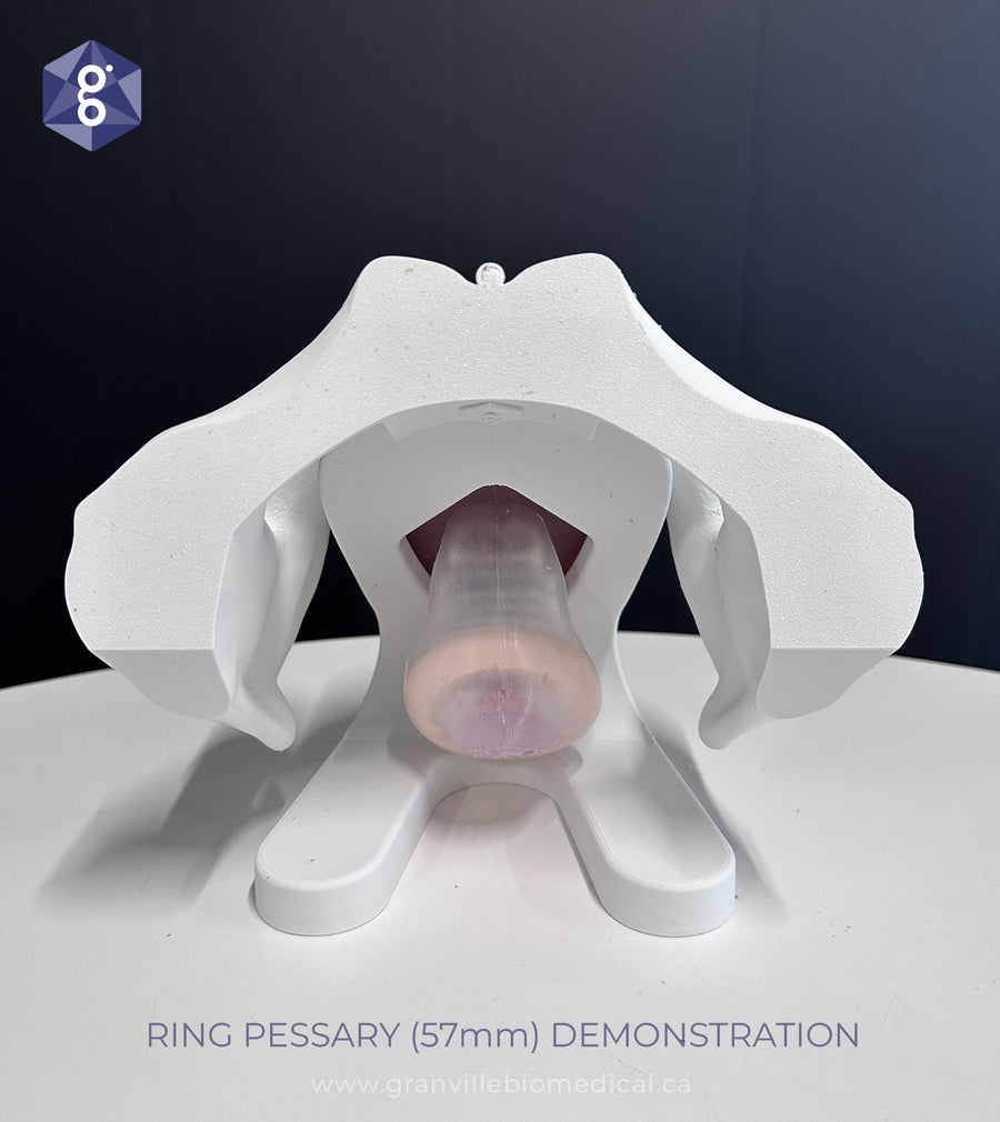 Iris - Pessary & Device Demonstration Model